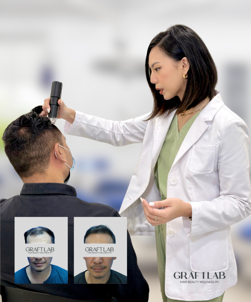 GraftLab Philippines 1 Hair Transplant PHILIPPINES, Hair Transplant Malaysia - Hair Consultation