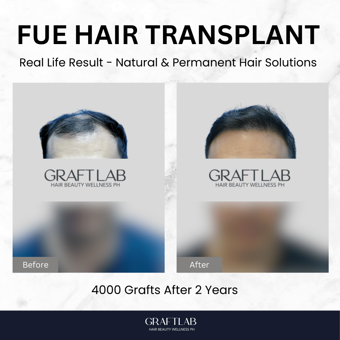 GraftLab Philippines 13 1