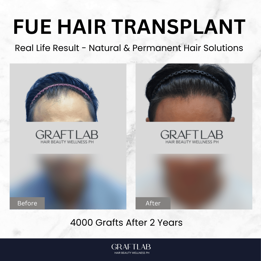GraftLab Philippines 14 2
