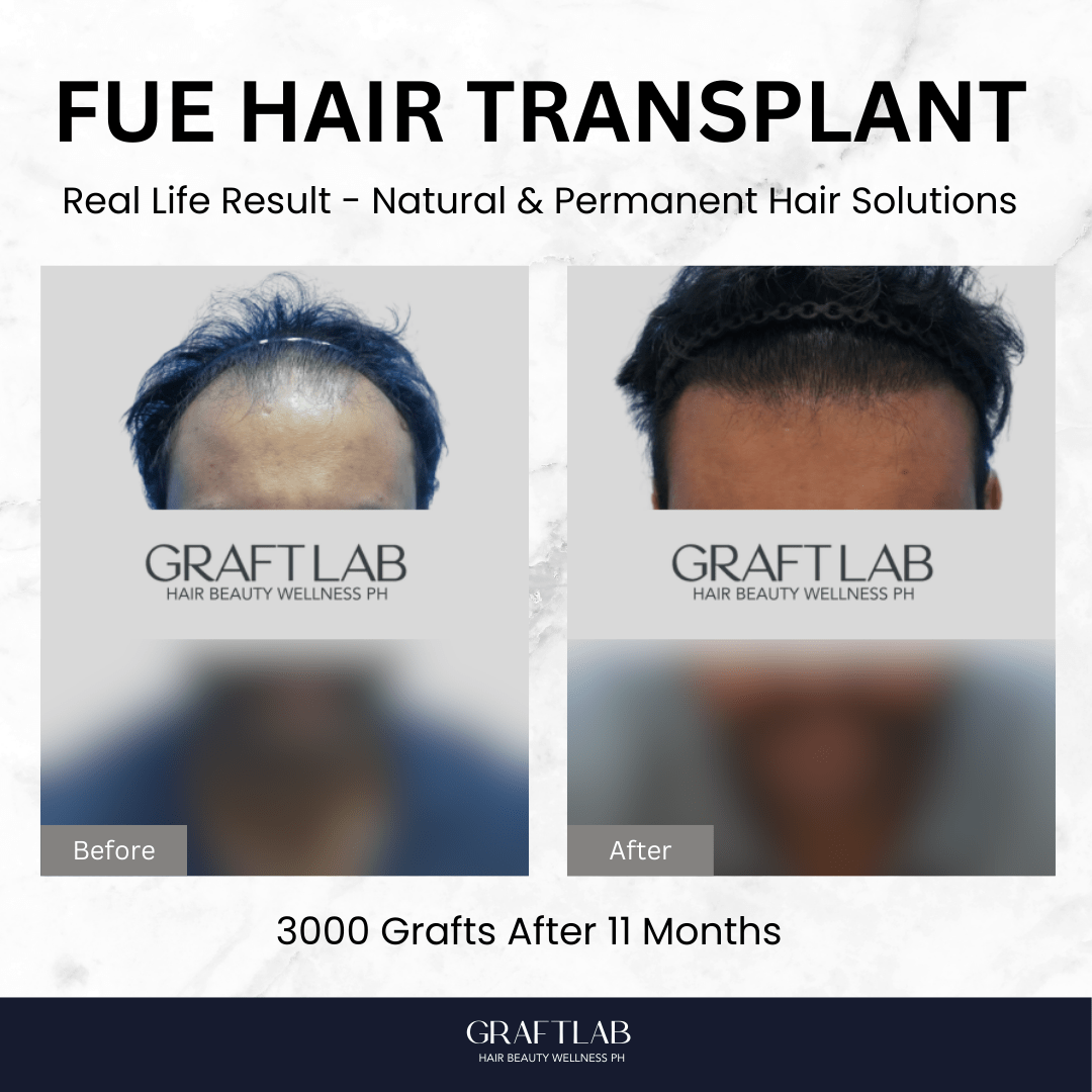 GraftLab Philippines 15 3