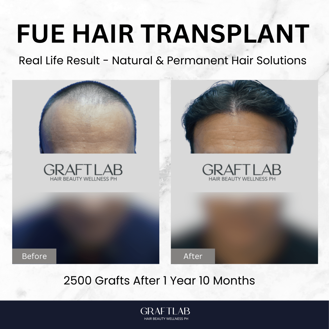 GraftLab Philippines 17 5